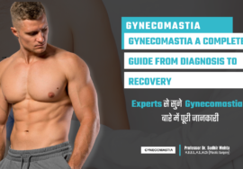 Gynecomastia