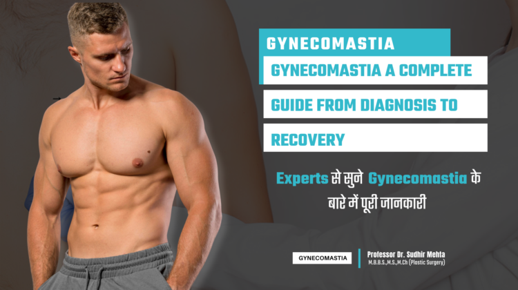 Gynecomastia