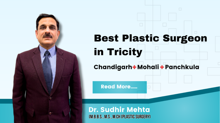 Plastic Surgeon in Tricity