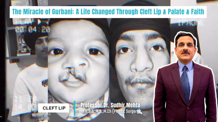 Cleft Lip
