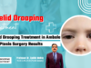 Eyelid Drooping