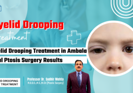 Eyelid Drooping