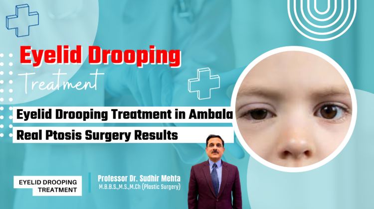 Eyelid Drooping