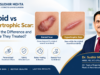 Keloid vs Hypertrophic Scar Guide