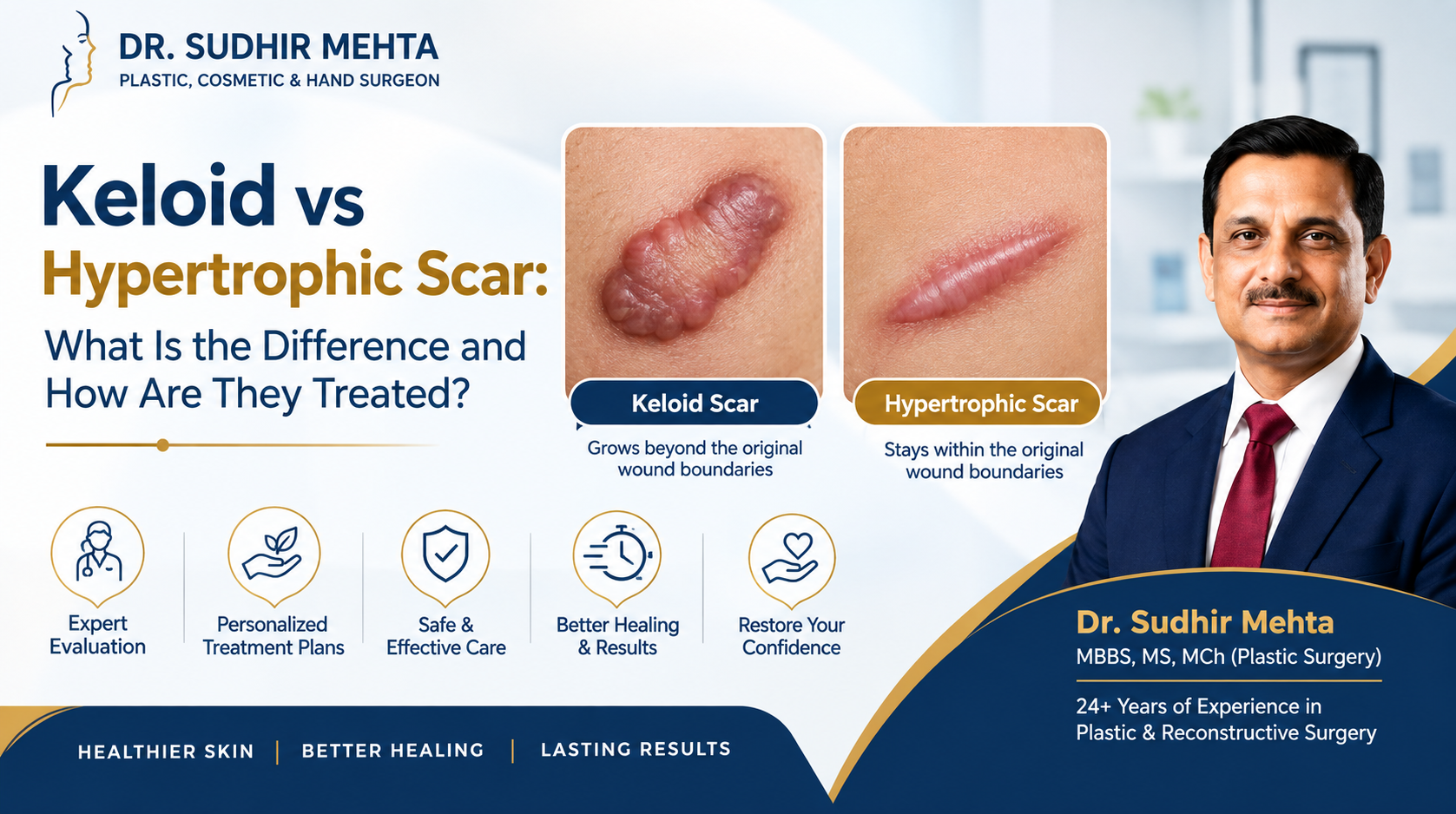 Keloid vs Hypertrophic Scar Guide