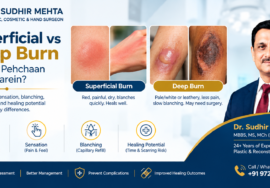 superficial vs deep burn