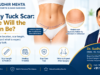 tummy tuck scar